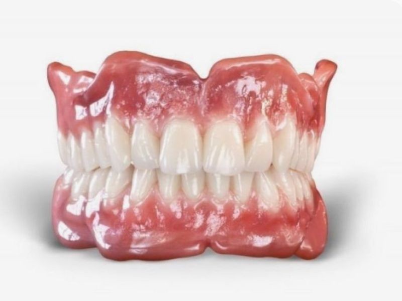 O que é uma prótese dentária e quando é indicada?