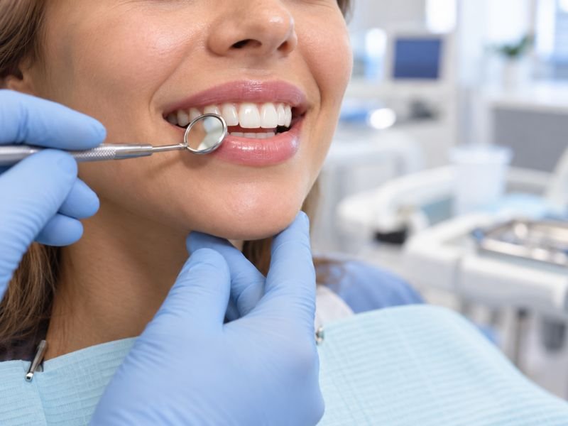 Facetas em Resina Doem? Entenda Como é Feito o Procedimento no Consultório Odontológico