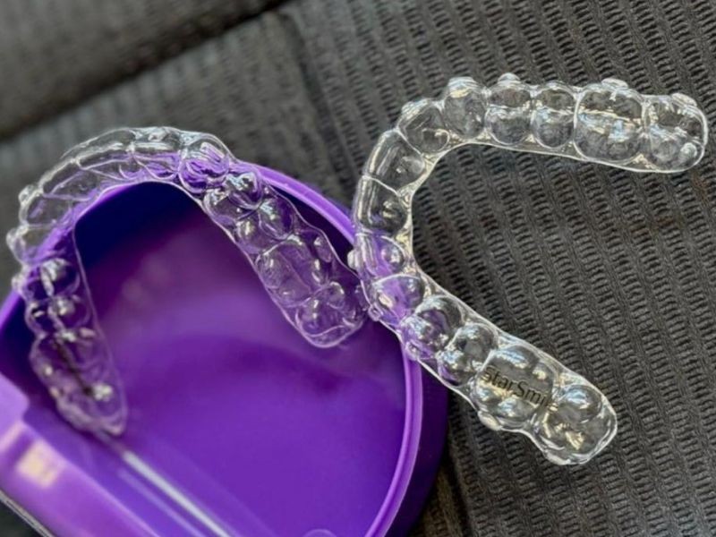 Alinhadores estéticos ou aparelho invisível: qual é a melhor opção para alinhar os dentes?