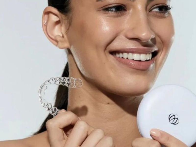 Alinhadores estéticos funcionam mesmo? Veja resultados e vantagens do tratamento