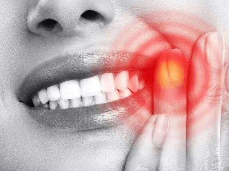 Inchaço na Gengiva ou no Rosto: Quando Procurar Atendimento Odontológico Imediato