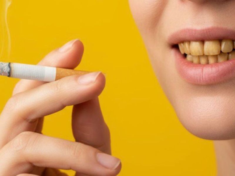 Sou fumante: posso fazer implante dentário?