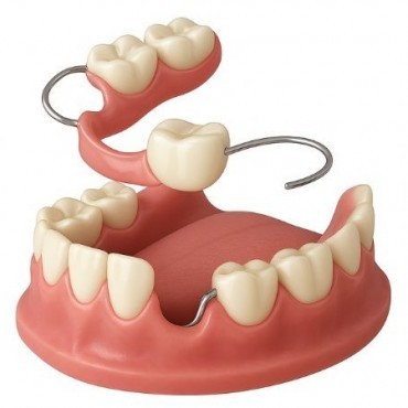 Próteses Dentárias em Senador Canedo