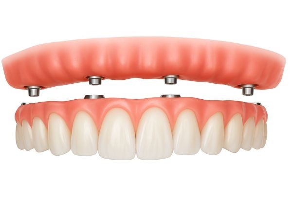 Características do Protocolo Dentário